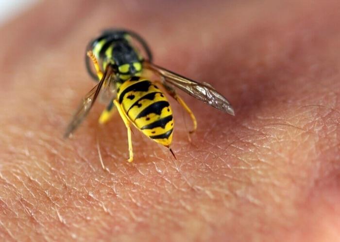 wasp sting