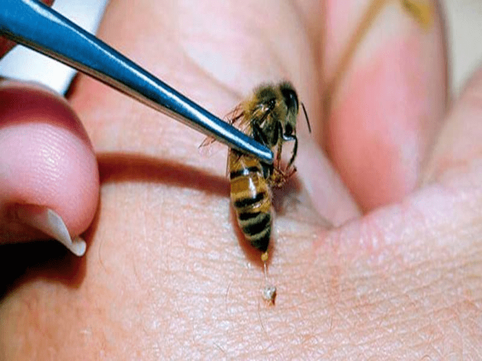 včelí žihadlo