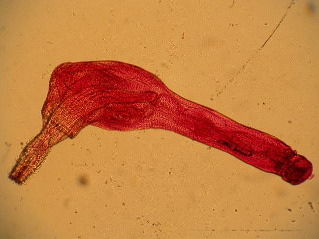 worm Acanthocephalans