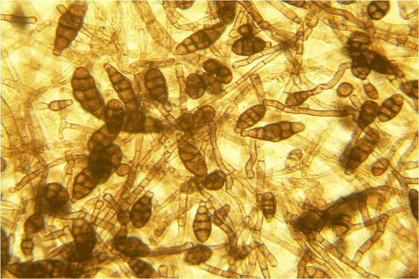 nhiễm trùng conidia