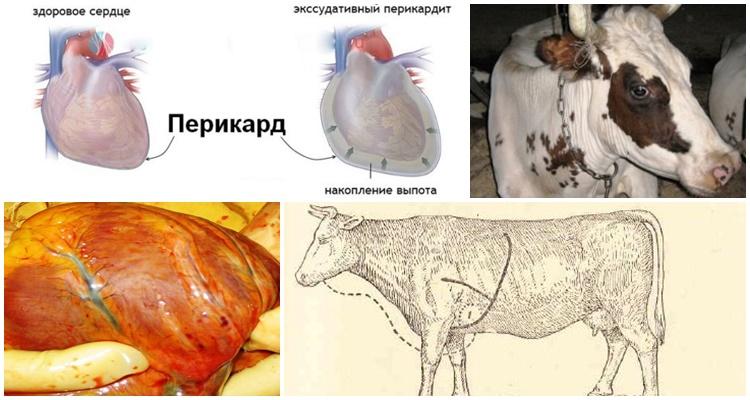 traumatic pericarditis