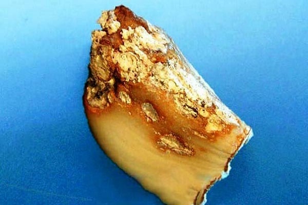 podridão bacteriana